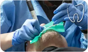 Chirurgia dentale Bologna