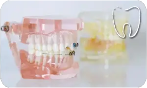 Ortodonzia dentale Dott.ssa piana Bologna