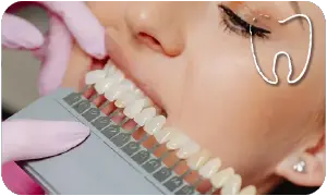 Sbiancamento dentale bologna