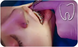 ortodonzia pediatrica bologna