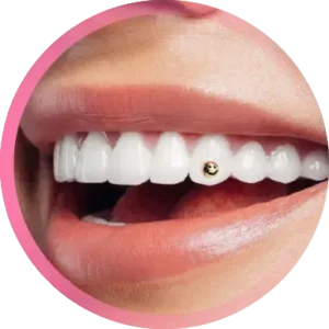Brillantino dente bologna
