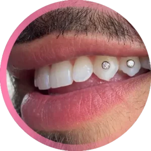 Brillantino dente uomo bologna