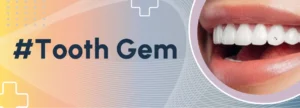 tooth gem Bologna e provincia, brillantini dente