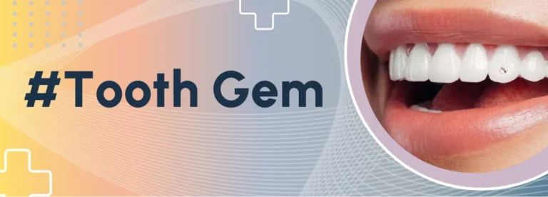 tooth gem Bologna e provincia, brillantini dente