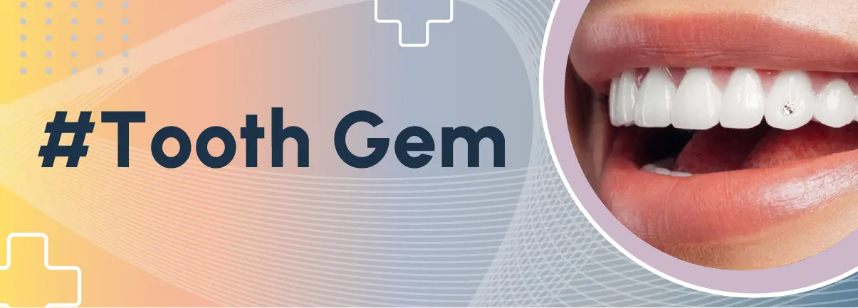 tooth gem Bologna e provincia, brillantini dente