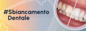 Sbiancamento dentale Rastignano e Monterenzio
